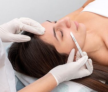Dermaplanning in Naples